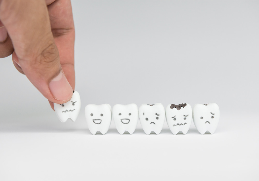 乳歯のむし歯の特徴