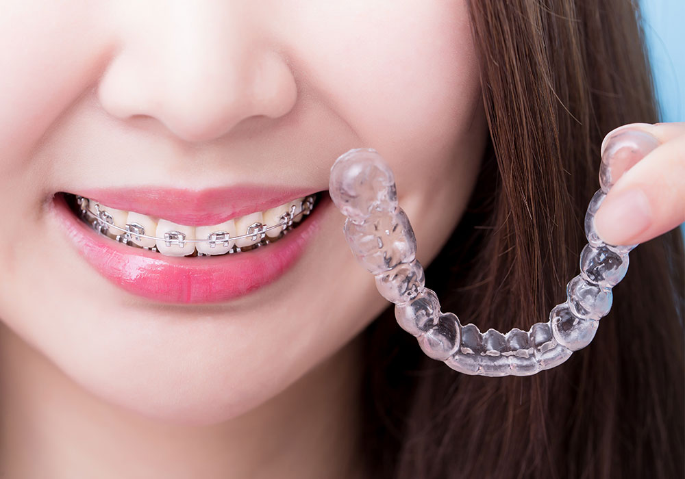 矯正歯科・小児矯正歯科