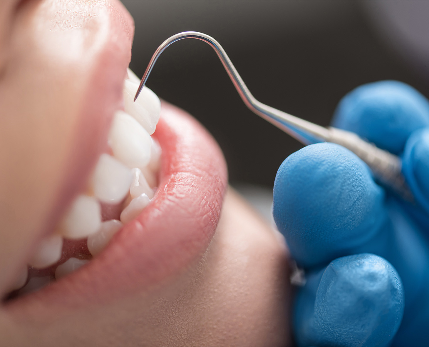 むし歯・歯周病にならないお口づくりをサポート